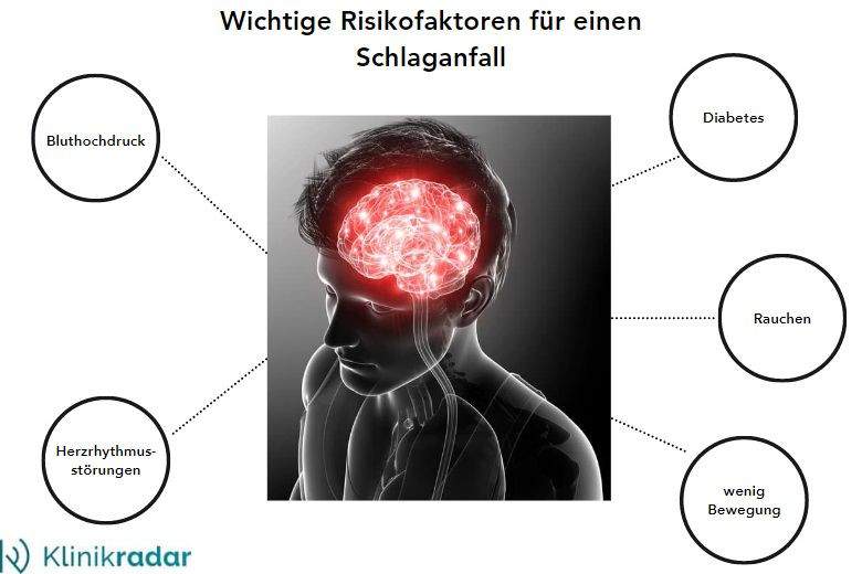 Schlaganfall Anzeichen Arten Risikofaktoren Klinikradar